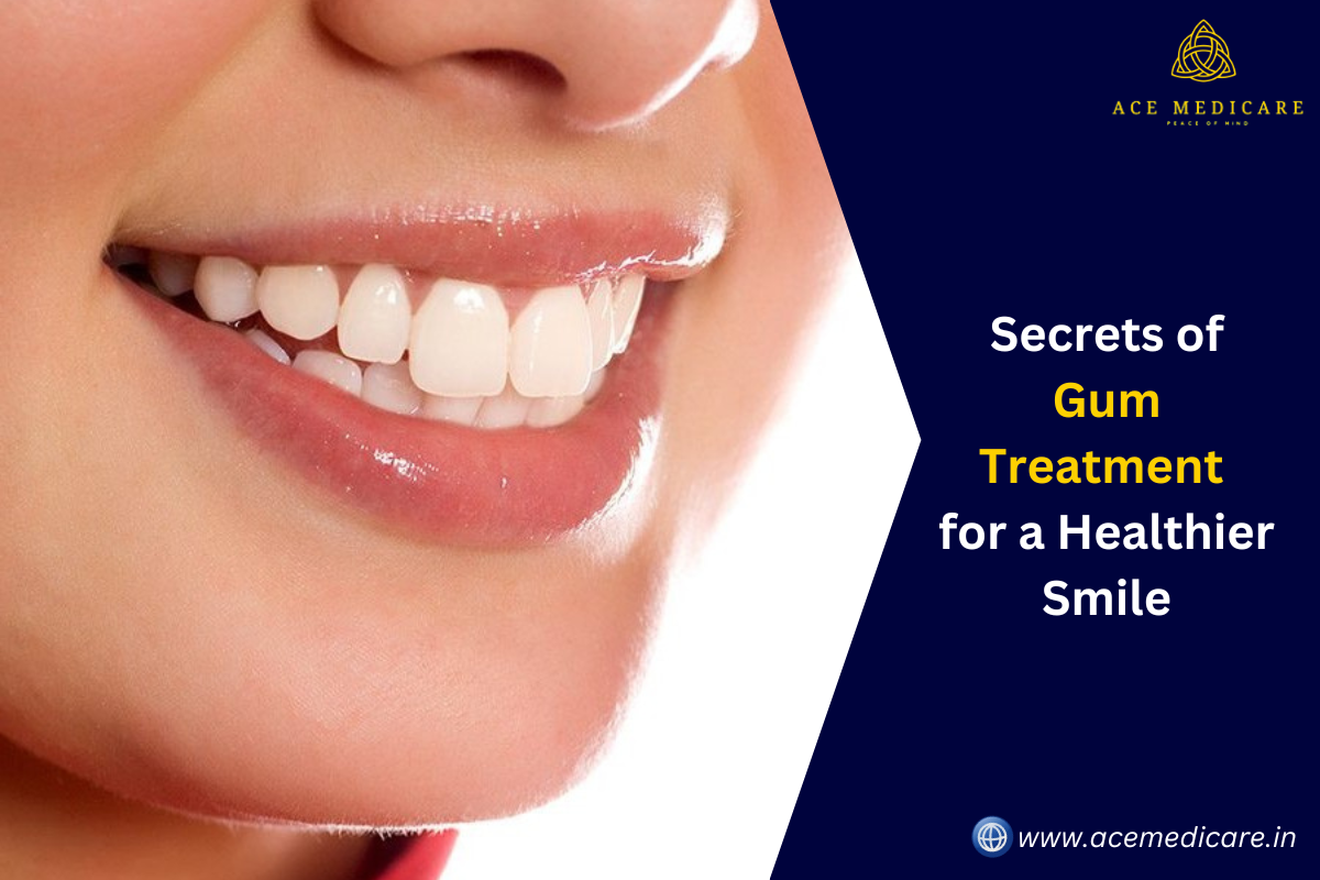 Secrets of Gum Treatment for a Healthier Smile